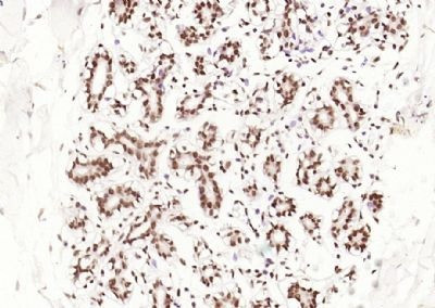 Phospho-ESR1 (Ser118) Antibody in Immunohistochemistry (Paraffin) (IHC (P))