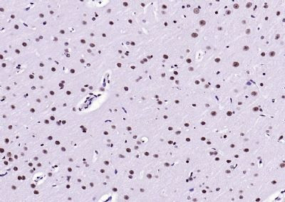 Phospho-NFE2L2 (Ser40) Antibody in Immunohistochemistry (Paraffin) (IHC (P))