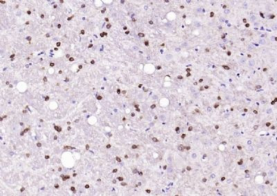 Phospho-EIF2AK2 (Thr446) Antibody in Immunohistochemistry (Paraffin) (IHC (P))