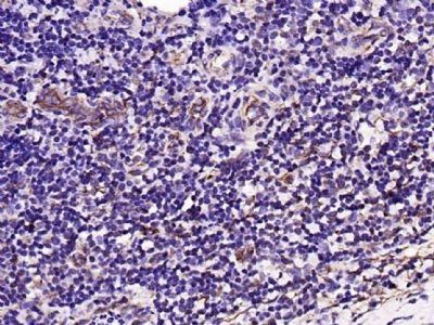ITGA6 Antibody in Immunohistochemistry (Paraffin) (IHC (P))