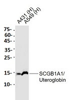 SCGB1A1 Antibody in Western Blot (WB)