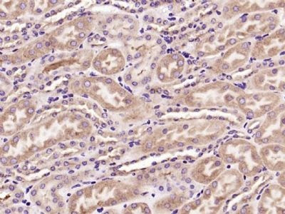 CXCR5 Antibody in Immunohistochemistry (Paraffin) (IHC (P))