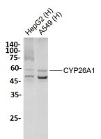 CYP26A1 Antibody in Western Blot (WB)