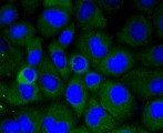 LRP1 Antibody in Immunocytochemistry (ICC/IF)