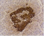 INS Antibody in Immunohistochemistry (Paraffin) (IHC (P))