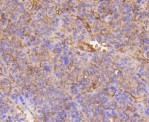 ITGB1 Antibody in Immunohistochemistry (Paraffin) (IHC (P))