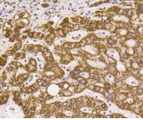 VDAC1 Antibody in Immunohistochemistry (Paraffin) (IHC (P))