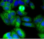 NGFR Antibody in Immunocytochemistry (ICC/IF)