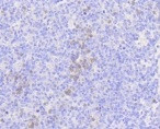 MLKL Antibody in Immunohistochemistry (Paraffin) (IHC (P))