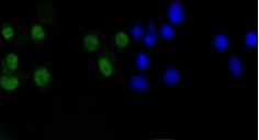 CCND1 Antibody in Immunocytochemistry (ICC/IF)