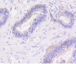 CTNNB1 Antibody in Immunohistochemistry (Paraffin) (IHC (P))