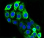 KRT20 Antibody in Immunocytochemistry (ICC/IF)
