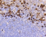 CD9 Antibody in Immunohistochemistry (Paraffin) (IHC (P))