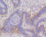 ITGA6 Antibody in Immunohistochemistry (Paraffin) (IHC (P))