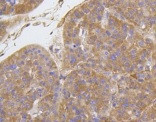 ITGB1 Antibody in Immunohistochemistry (Paraffin) (IHC (P))
