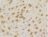 CDK5 Antibody in Immunohistochemistry (Paraffin) (IHC (P))
