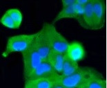 CASP2 Antibody in Immunocytochemistry (ICC/IF)
