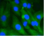 HSPA8 Antibody in Immunocytochemistry (ICC/IF)