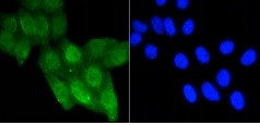 Acetyl-TP53 (Lys370) Antibody in Immunocytochemistry (ICC/IF)