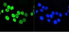 H4K5ac Antibody in Immunocytochemistry (ICC/IF)