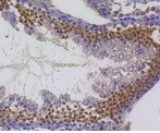 Birc5 Antibody in Immunohistochemistry (Paraffin) (IHC (P))