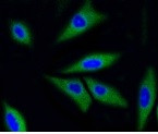 CDK2 Antibody in Immunocytochemistry (ICC/IF)