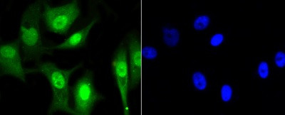 CBX5 Antibody in Immunocytochemistry (ICC/IF)