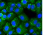 RELA Antibody in Immunocytochemistry (ICC/IF)