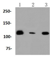 RNF20 Antibody in Western Blot (WB)