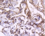 PDGFRB Antibody in Immunohistochemistry (Paraffin) (IHC (P))