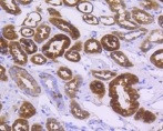 ALDH1A1 Antibody in Immunohistochemistry (Paraffin) (IHC (P))