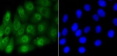 Phospho-SMAD5 (Ser463, Ser465) Antibody in Immunocytochemistry (ICC/IF)