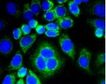 CNN1 Antibody in Immunocytochemistry (ICC/IF)