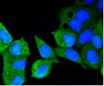ATM Antibody in Immunocytochemistry (ICC/IF)