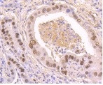 Phospho-TP53 (Ser392) Antibody in Immunohistochemistry (Paraffin) (IHC (P))