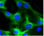 DES Antibody in Immunocytochemistry (ICC/IF)