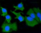 MMP14 Antibody in Immunocytochemistry (ICC/IF)