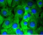 NOTCH1 Antibody in Immunocytochemistry (ICC/IF)