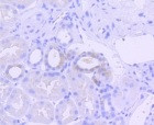 Phospho-EIF2AK2 (Thr446) Antibody in Immunohistochemistry (Paraffin) (IHC (P))