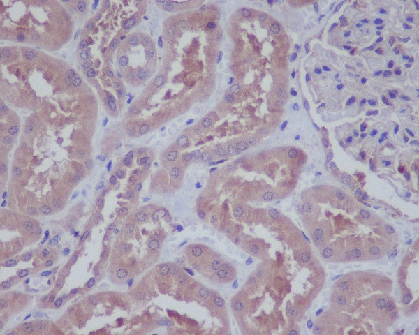 HAPLN1 Antibody in Immunohistochemistry (Paraffin) (IHC (P))