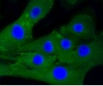 CALD1 Antibody in Immunocytochemistry (ICC/IF)