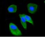 UBB Antibody in Immunocytochemistry (ICC/IF)