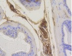 RAB5A Antibody in Immunohistochemistry (Paraffin) (IHC (P))