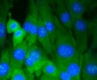 DNMT3A Antibody in Immunocytochemistry (ICC/IF)