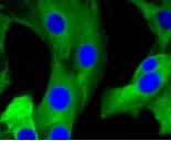 GRM5 Antibody in Immunocytochemistry (ICC/IF)
