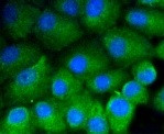 VTN Antibody in Immunocytochemistry (ICC/IF)