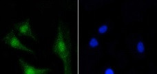 PRKCB Antibody in Immunocytochemistry (ICC/IF)