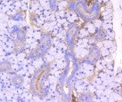 ROCK1 Antibody in Immunohistochemistry (Paraffin) (IHC (P))