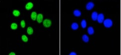 PIM1 Antibody in Immunocytochemistry (ICC/IF)