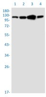 IDE Antibody in Western Blot (WB)
